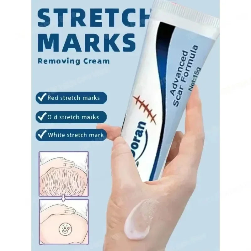 Removing Old Red and White Line Oil Stretch Mark Repair for Pregnant Women Anti-wrinkle Care