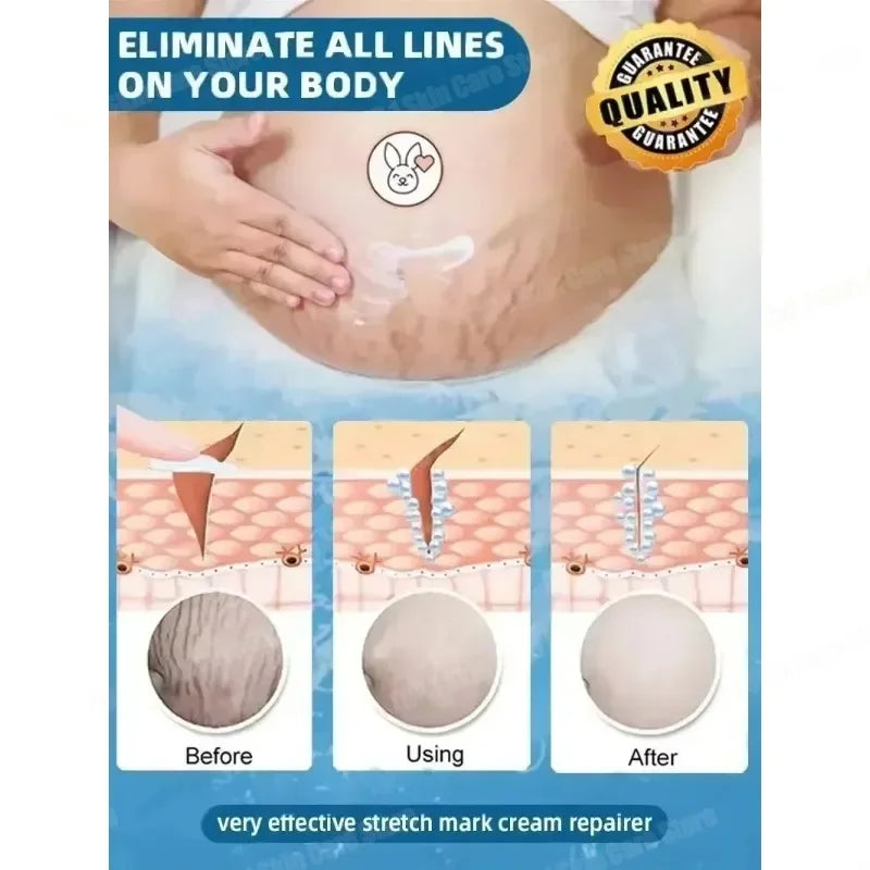 Removing Old Red and White Line Oil Stretch Mark Repair for Pregnant Women Anti-wrinkle Care