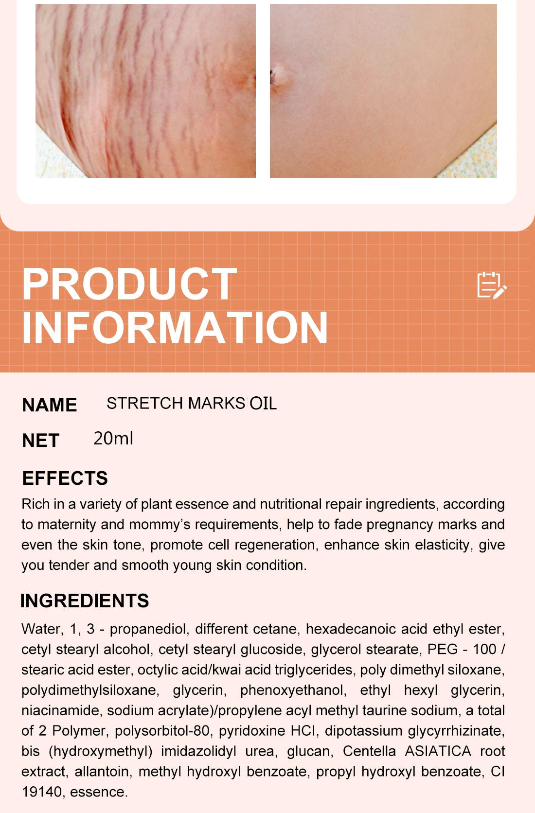 Stretch Marks Desalinate Essential Oil Skin Care