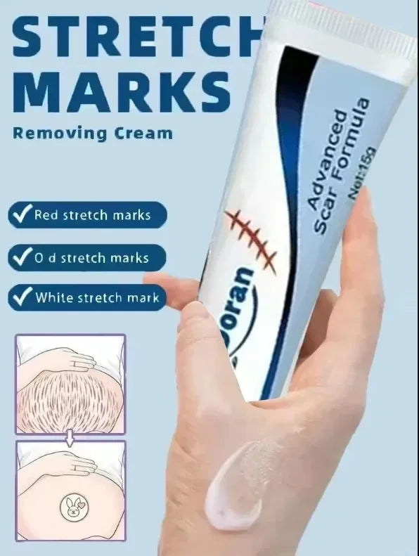 Removing Old Red and White Line Oil Stretch Mark Repair for Pregnant Women Anti-wrinkle Care