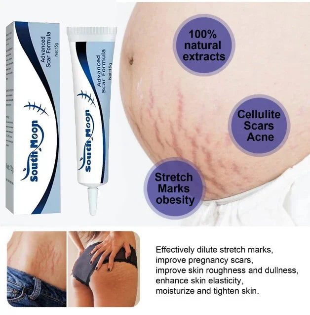 Removing Old Red and White Line Oil Stretch Mark Repair for Pregnant Women Anti-wrinkle Care