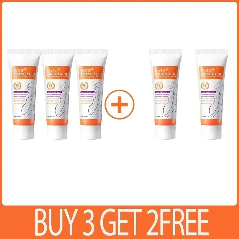 Maternity Stretch Mark Permanent Removal cream Brighten Anti-Winkle