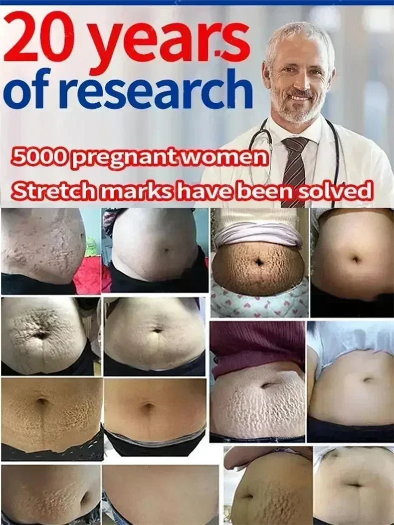 Maternity Stretch Mark Permanent Removal cream Brighten Anti-Winkle