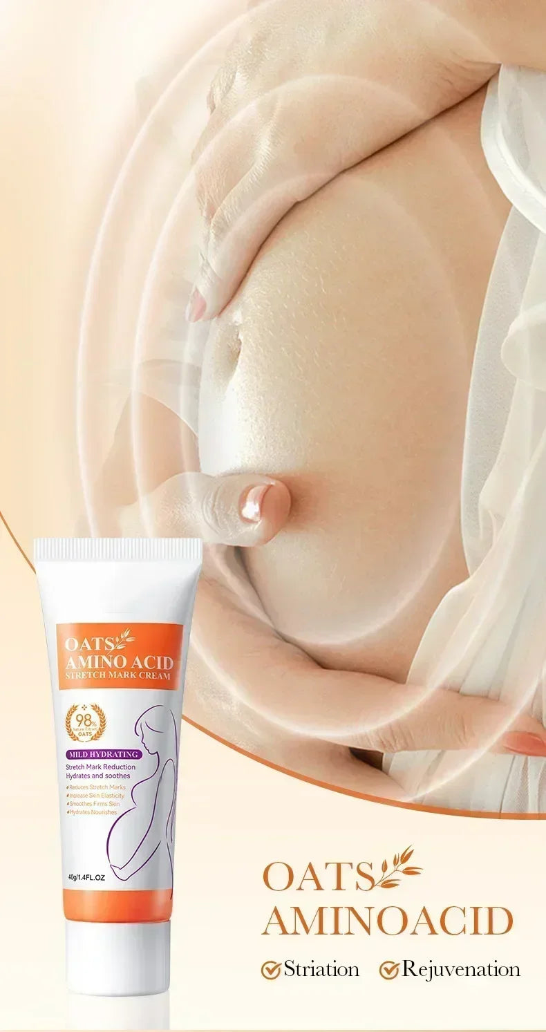Maternity Stretch Mark Permanent Removal cream Brighten Anti-Winkle