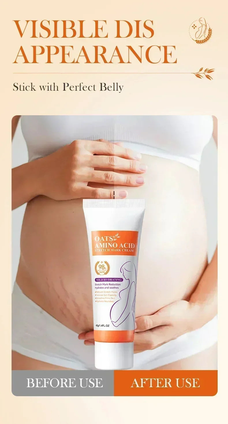 Maternity Stretch Mark Permanent Removal cream Brighten Anti-Winkle