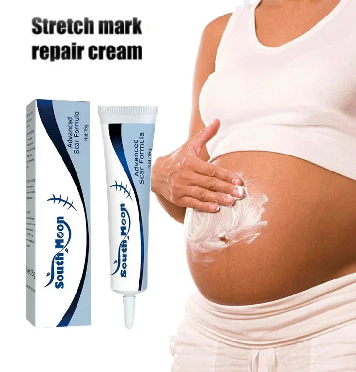 Removing Old Red and White Line Oil Stretch Mark Repair for Pregnant Women Anti-wrinkle Care