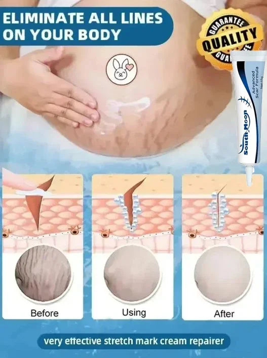 Removing Old Red and White Line Oil Stretch Mark Repair for Pregnant Women Anti-wrinkle Care