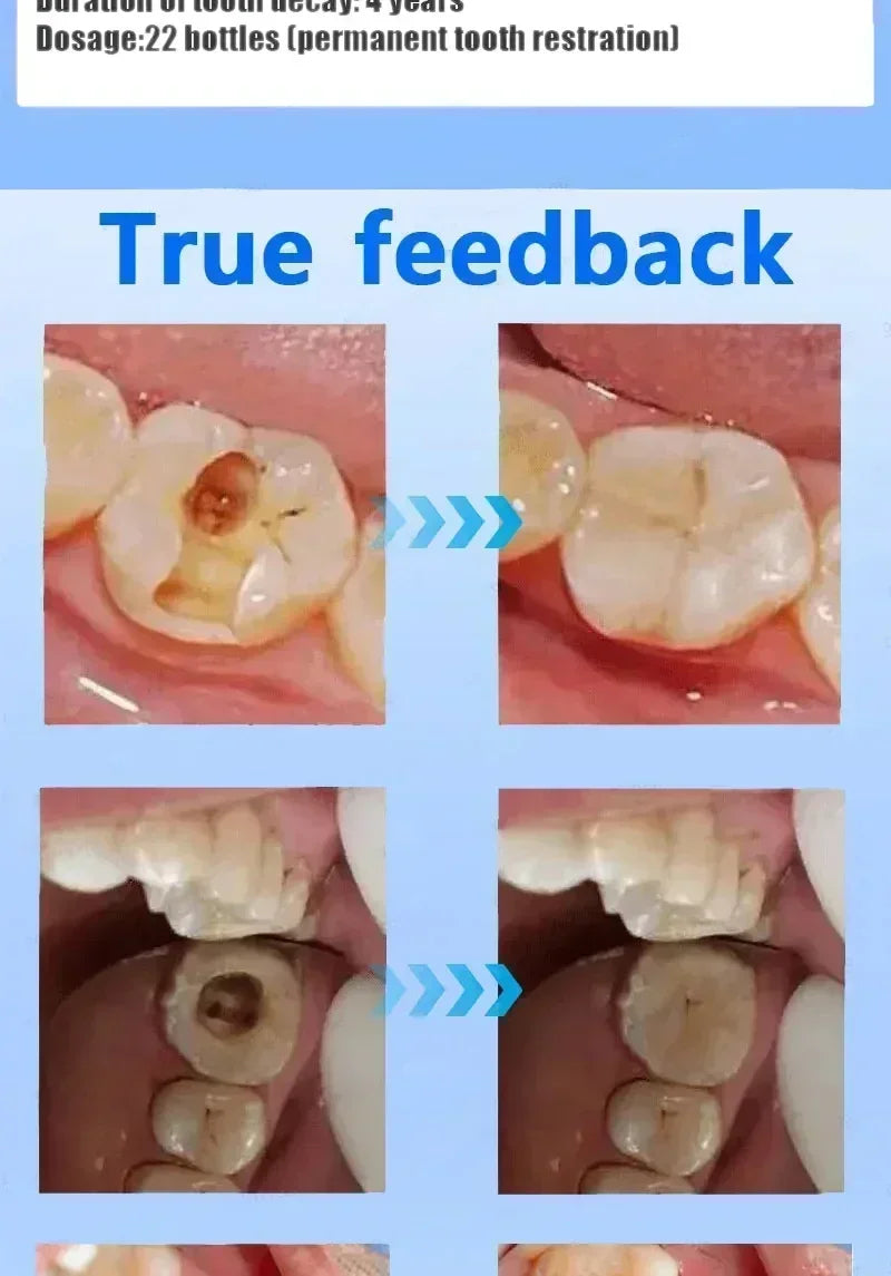 Toothpaste of Teeth Whitening Repair of Cavities Caries Removal of Plaque Stains Decay