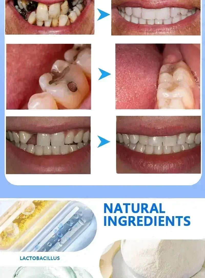 Toothpaste of Teeth Whitening Repair of Cavities Caries Removal of Plaque Stains Decay