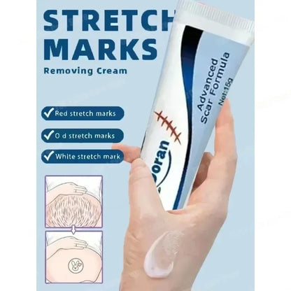 Removing Old Red and White Line Oil Stretch Mark Repair for Pregnant Women Anti-wrinkle Care
