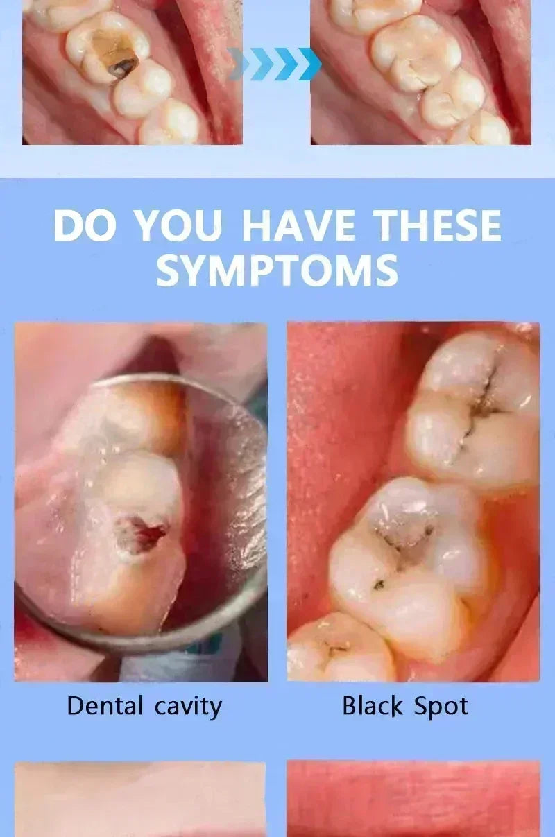 Toothpaste of Teeth Whitening Repair of Cavities Caries Removal of Plaque Stains Decay