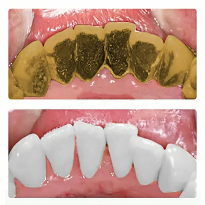 Toothpaste of Teeth Whitening Repair of Cavities Caries Removal of Plaque Stains Decay