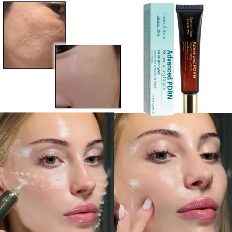 Korea Pdrn Rejuvenating Cream Salmon Dna Extract Facial Moisturizer Brighten Skin