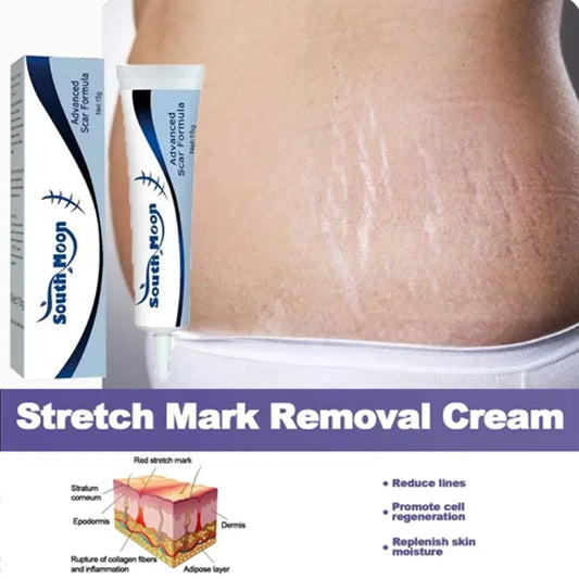 Removing Old Red and White Line Oil Stretch Mark Repair for Pregnant Women Anti-wrinkle Care