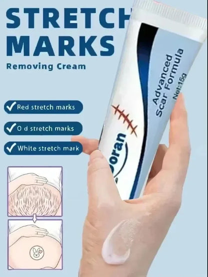 Removing Old Red and White Line Oil Stretch Mark Repair for Pregnant Women Anti-wrinkle Care