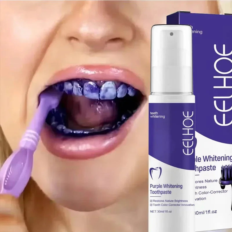 2026 Bestselling Whitening Toothpaste: Say Goodbye to Yellow Teeth