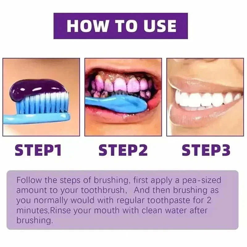2026 Bestselling Whitening Toothpaste: Say Goodbye to Yellow Teeth