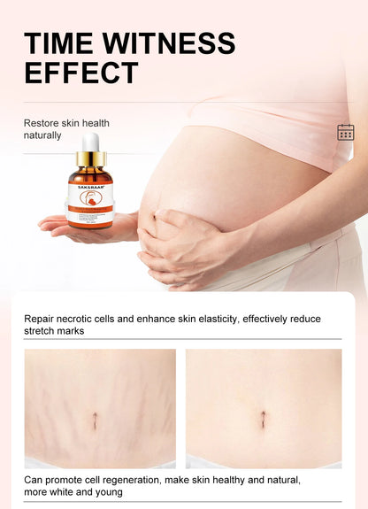 Stretch Marks Desalinate Essential Oil Skin Care