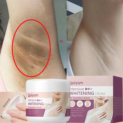 Crema blanqueadora para piel oscura, blanqueamiento de axilas, aclaramiento de axilas