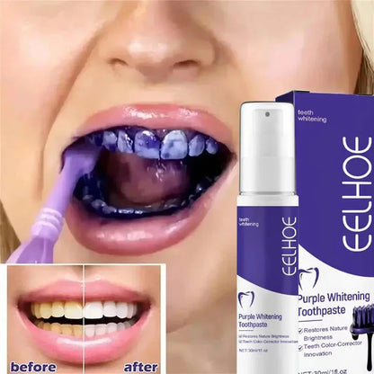 2026 Bestselling Whitening Toothpaste: Say Goodbye to Yellow Teeth