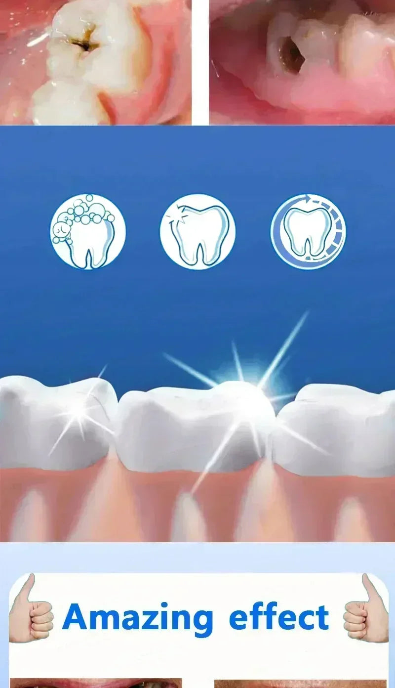 Toothpaste of Teeth Whitening Repair of Cavities Caries Removal of Plaque Stains Decay