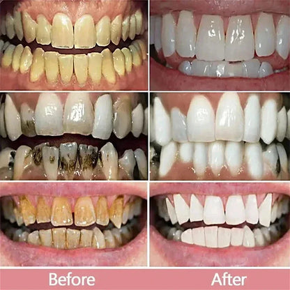 2026 Bestselling Whitening Toothpaste: Say Goodbye to Yellow Teeth