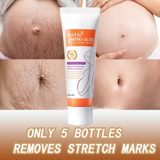 Maternity Stretch Mark Permanent Removal cream Brighten Anti-Winkle