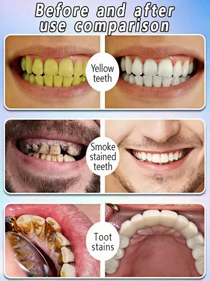 Toothpaste of Teeth Whitening Repair of Cavities Caries Removal of Plaque Stains Decay