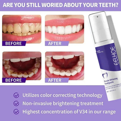 2026 Bestselling Whitening Toothpaste: Say Goodbye to Yellow Teeth