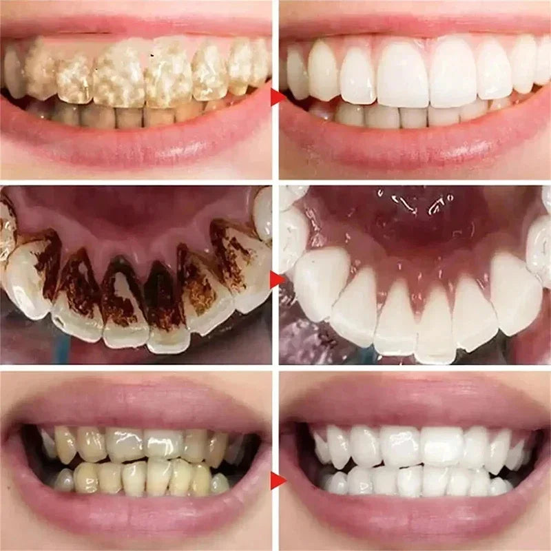 2026 Bestselling Whitening Toothpaste: Say Goodbye to Yellow Teeth