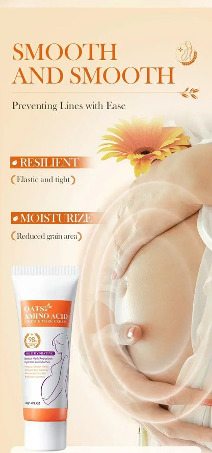 Maternity Stretch Mark Permanent Removal cream Brighten Anti-Winkle