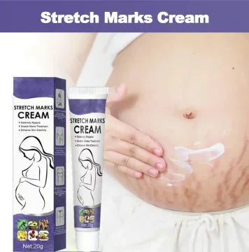 Remove Pregnancy Stretch Marks Cream Improves Elasticity Fade Growth Lines