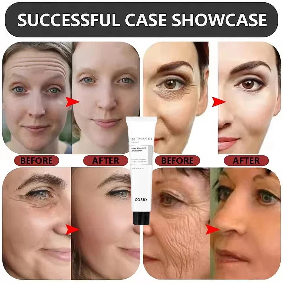 Creme facial antirrugas coreano refirmante com retinol 0,1 