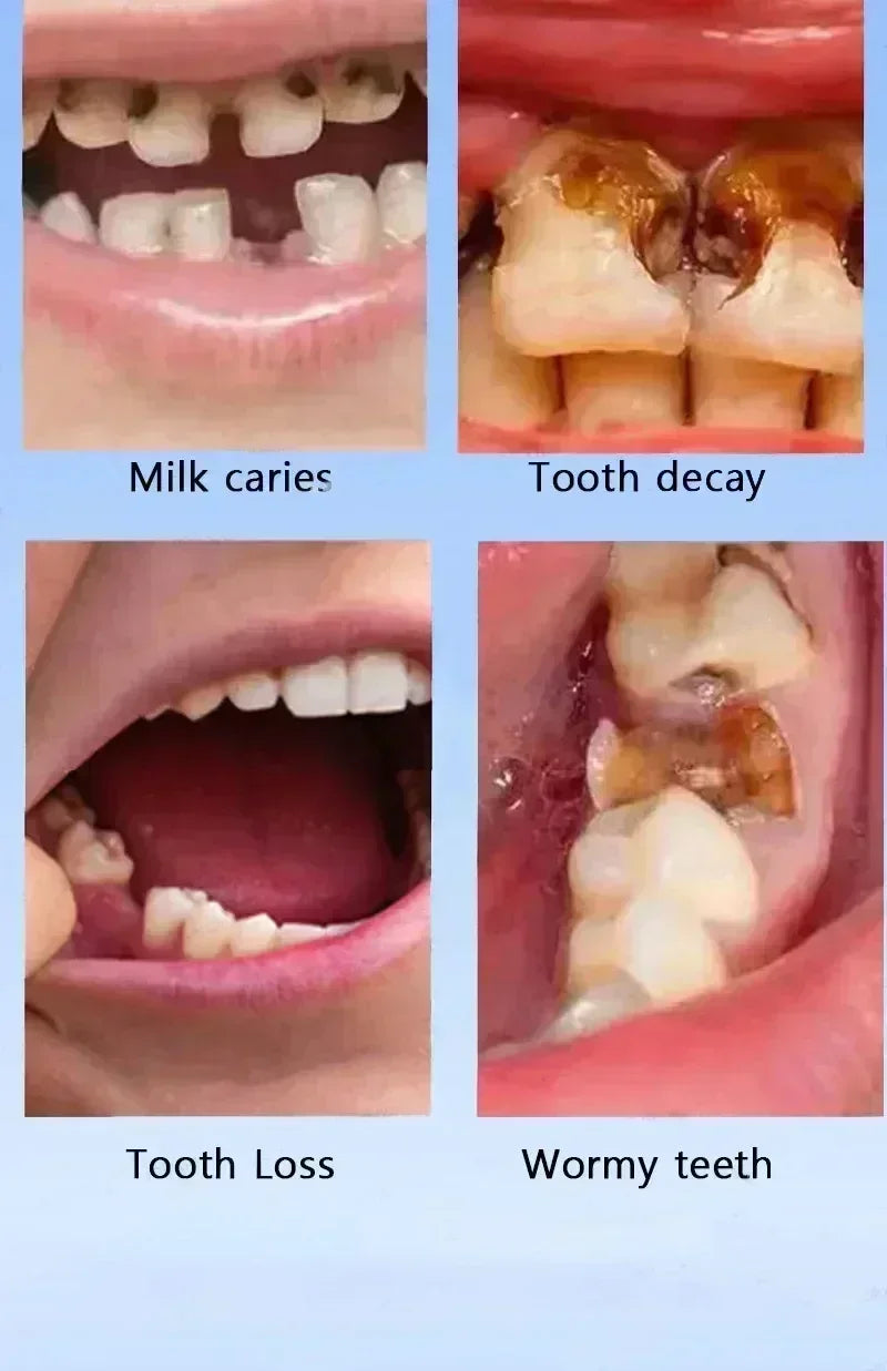 Toothpaste of Teeth Whitening Repair of Cavities Caries Removal of Plaque Stains Decay