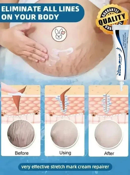 Removing Old Red and White Line Oil Stretch Mark Repair for Pregnant Women Anti-wrinkle Care