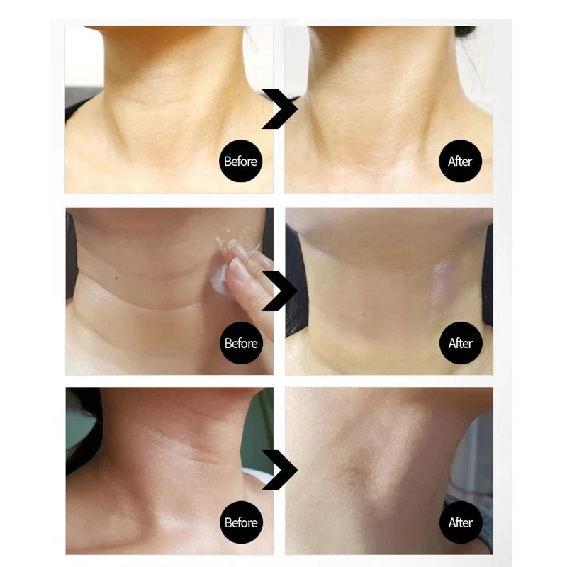 Crema para el cuello con hilo Naite (100 ml) con péptidos de colágeno hidrolizado de Corea y solución de adenosina al 5 % 