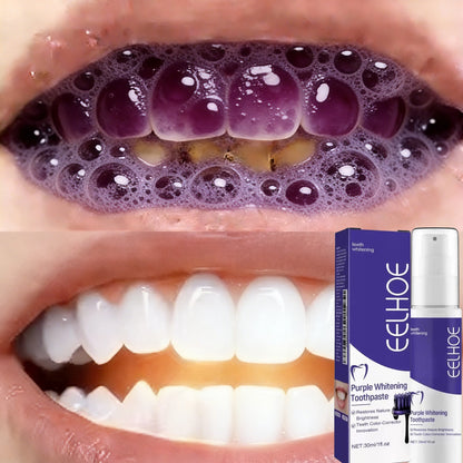 2026 Bestselling Whitening Toothpaste: Say Goodbye to Yellow Teeth
