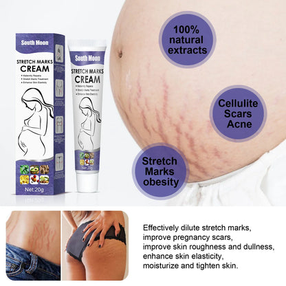 Remove Pregnancy Stretch Marks Cream Improves Elasticity Fade Growth Lines