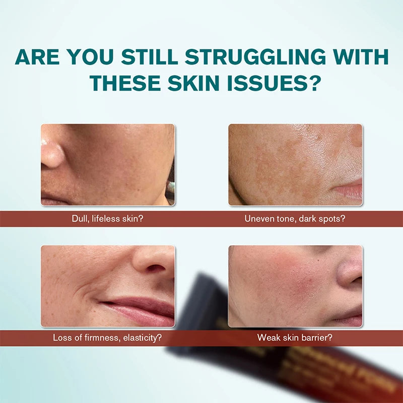 Korea Pdrn Rejuvenating Cream Salmon Dna Extract Facial Moisturizer Brighten Skin