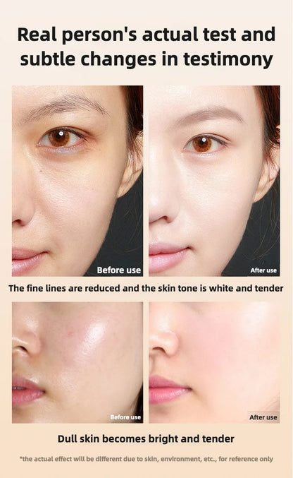 As ampolas faciais antirrugas de astaxantina removem manchas escuras e clareiam a melanina.