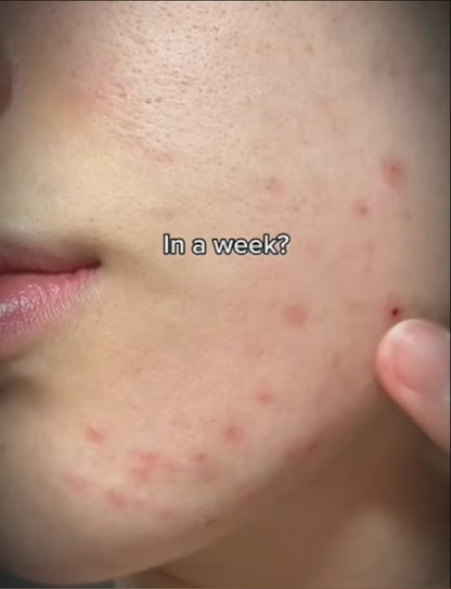 Korea Pdrn Rejuvenating Cream Salmon Dna Extract Facial Moisturizer Brighten Skin